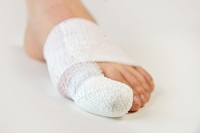 What to Do About Broken Toes